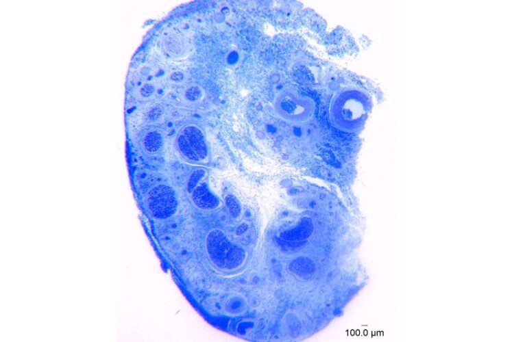 Coupe transversale agrandie du nerf dorsal du clitoris humain, principalement responsable de la sensation clitoridienne. Chaque point minuscule, bleu foncé, placé à l'intérieur des grands cercles bleus, représente une fibre nerveuse individuelle du nerf dorsal. Les chercheurs ont agrandi les échantillons au microscope 1 000 fois et utilisé un logiciel d'analyse d'images pour compter les fibres nerveuses.